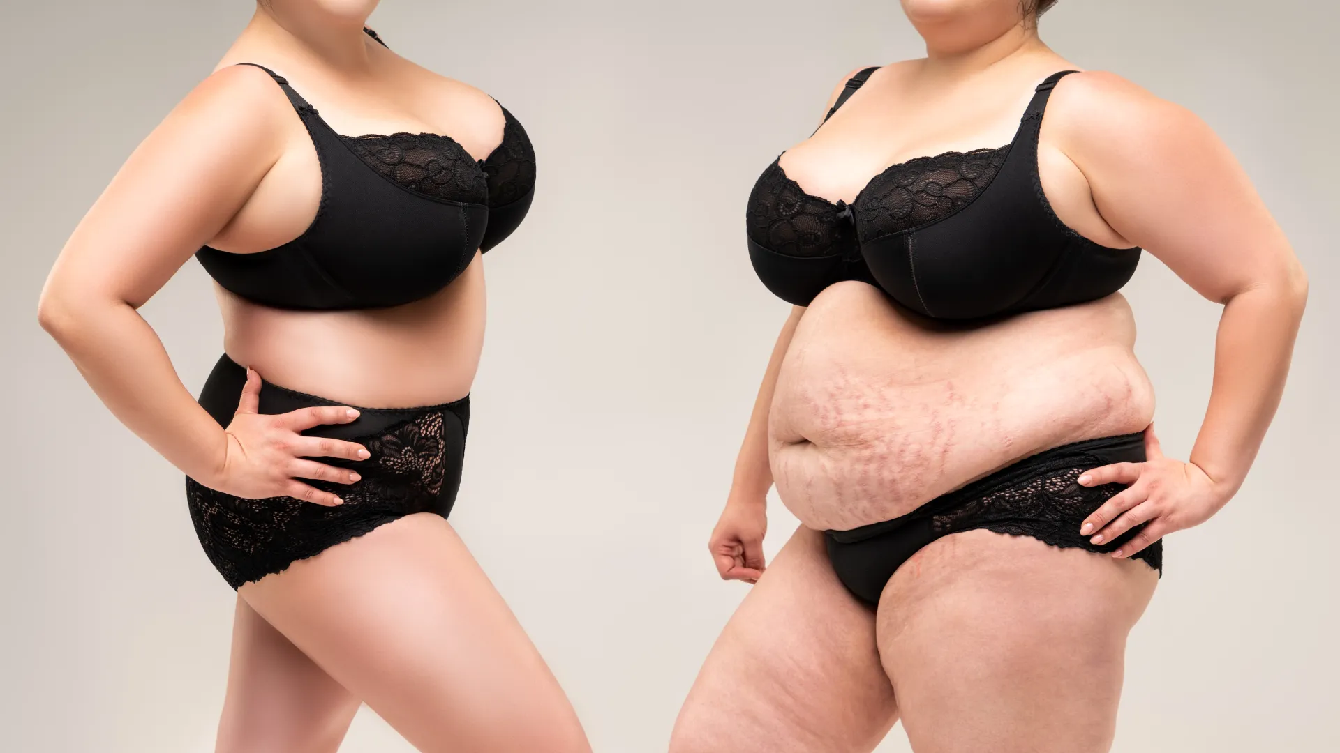 Aqualyx Fat Dissolving Injections